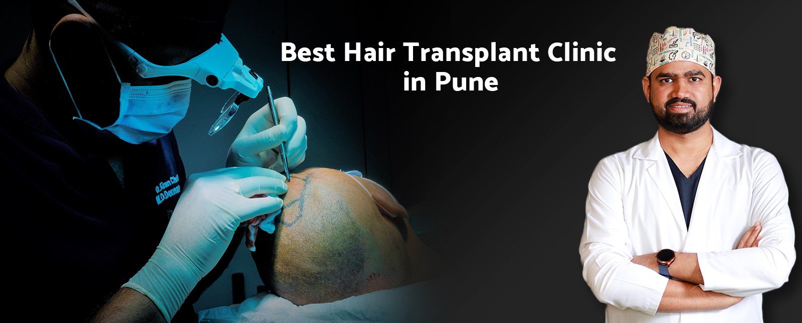 Best Hair Transplant Clinic in Pune: Dr. Kiran Chotaliya’s Expertise with the latest Hair Transplant Technique