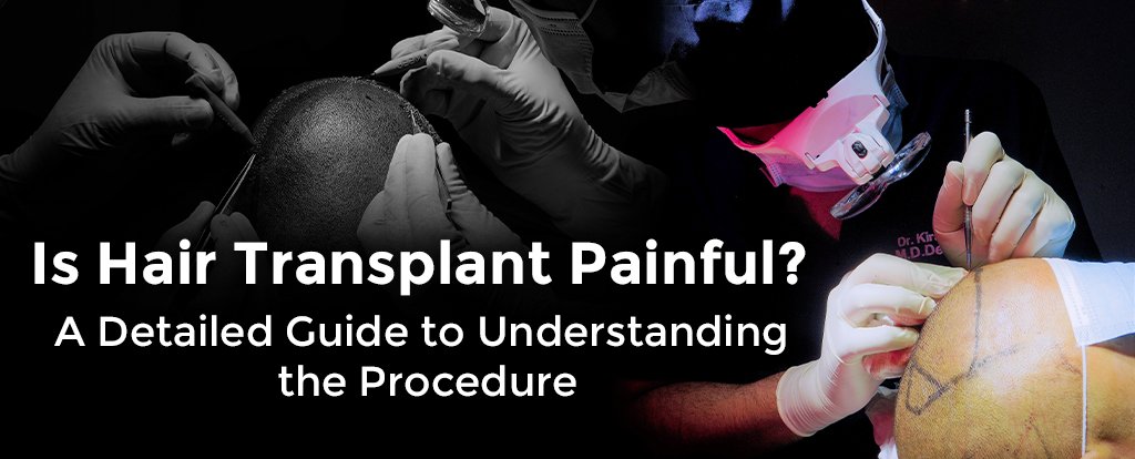 Is-Hair-Transplant-Painful-A-Detailed-Guide