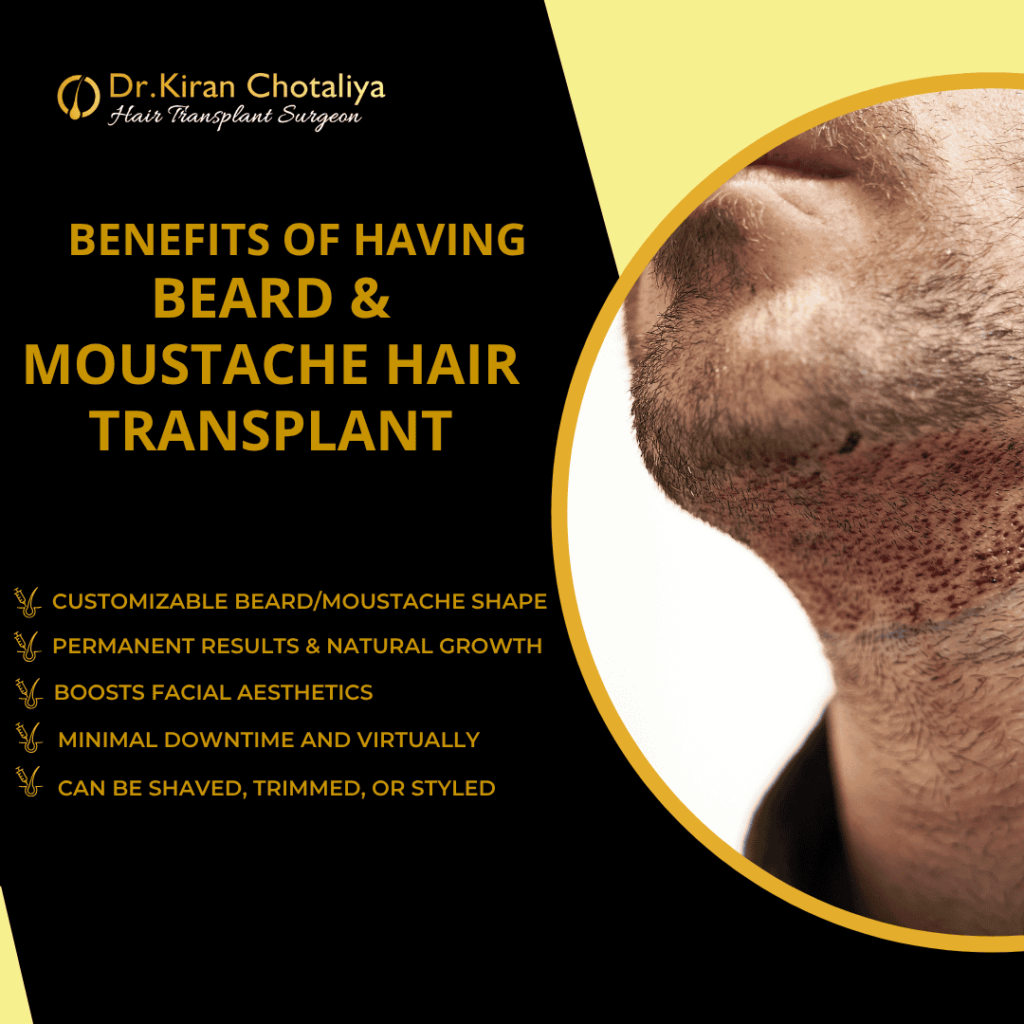 Benefits of beard transplant