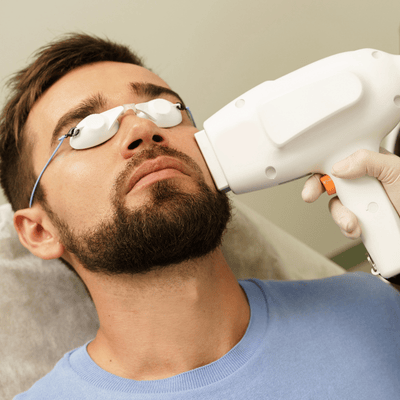 what is Beard shaping treatment