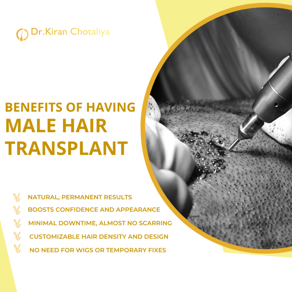 Male hair transplant benefits