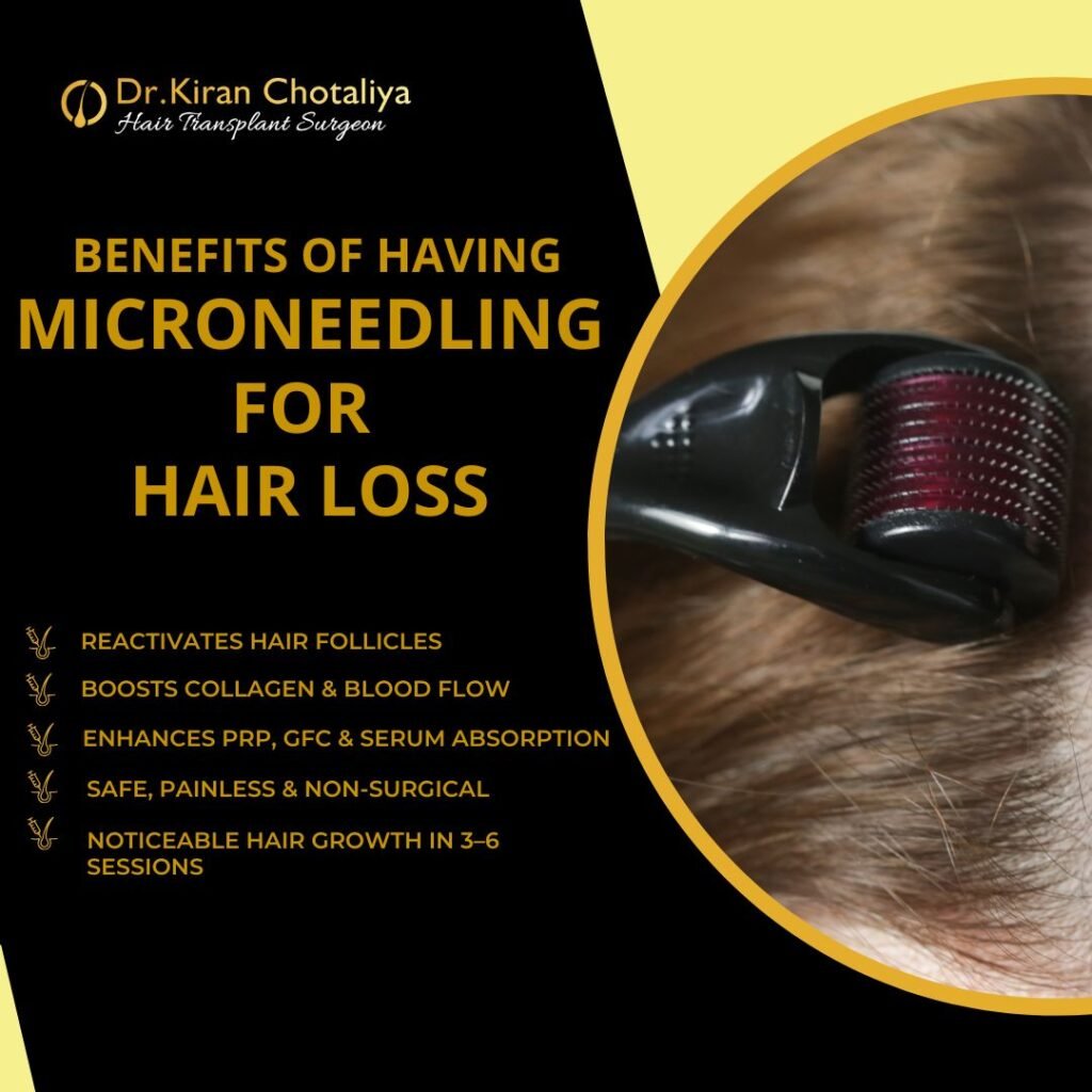 Benefits of micro needling for hair loss