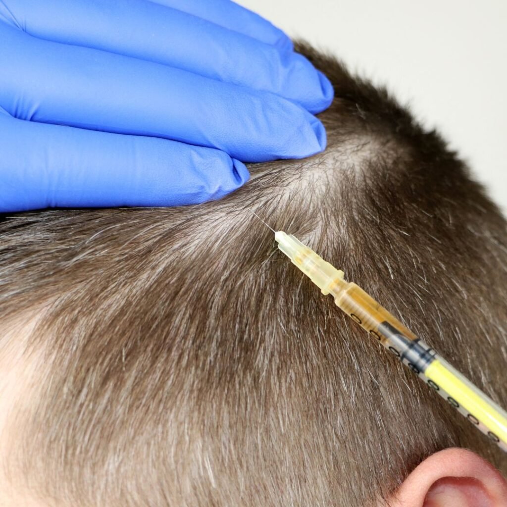 What is prp hair treatment