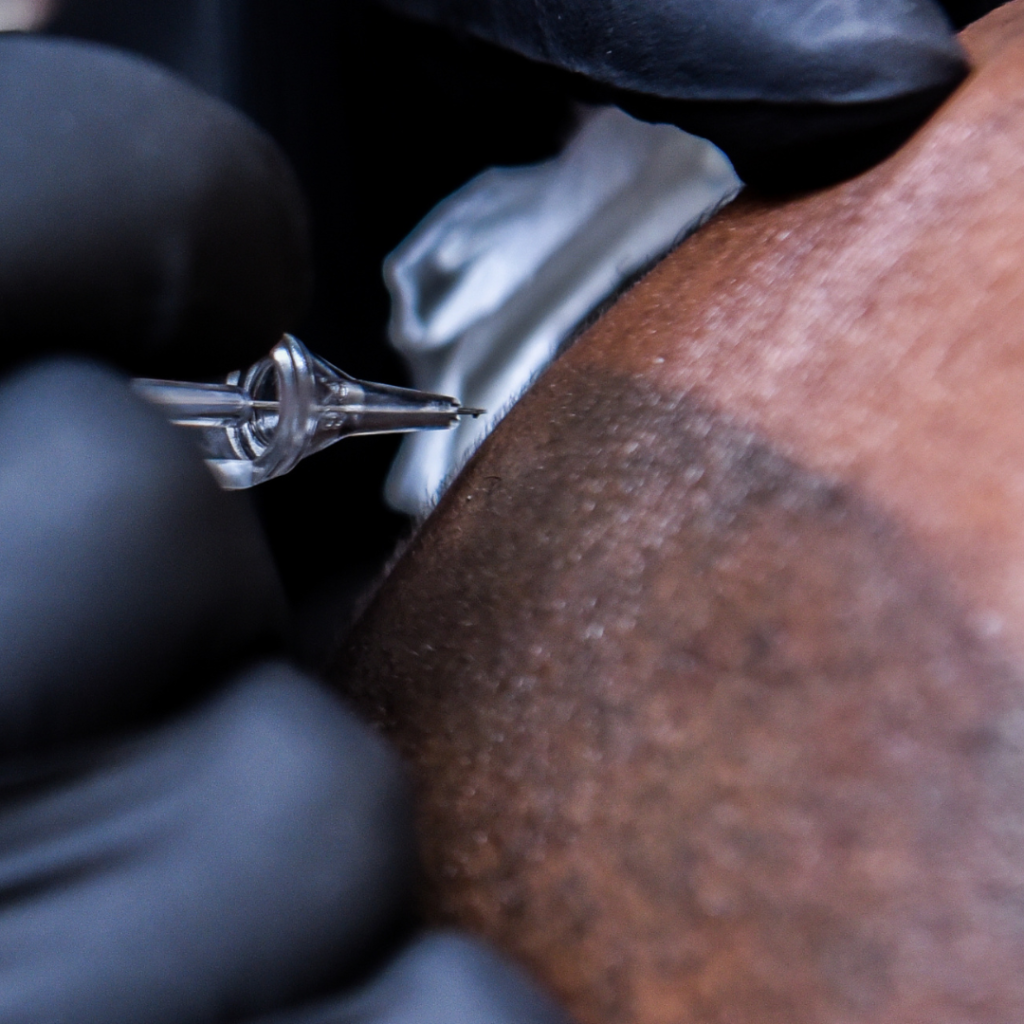 What is scalp micropigmentation for hair
