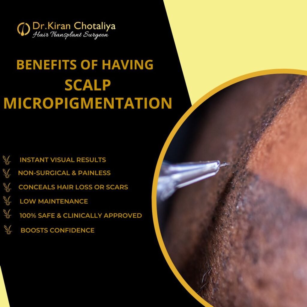 Benefits of scalp micropigmentation