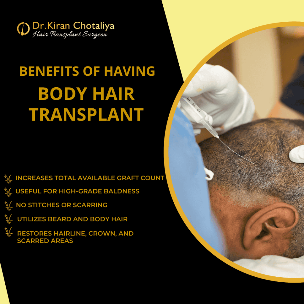 Body Hair Transplant