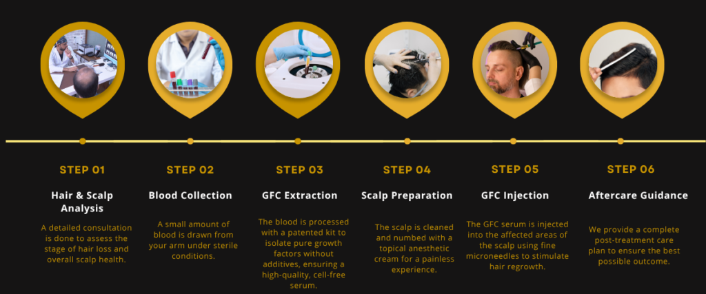 Steps in GFC hair transplant