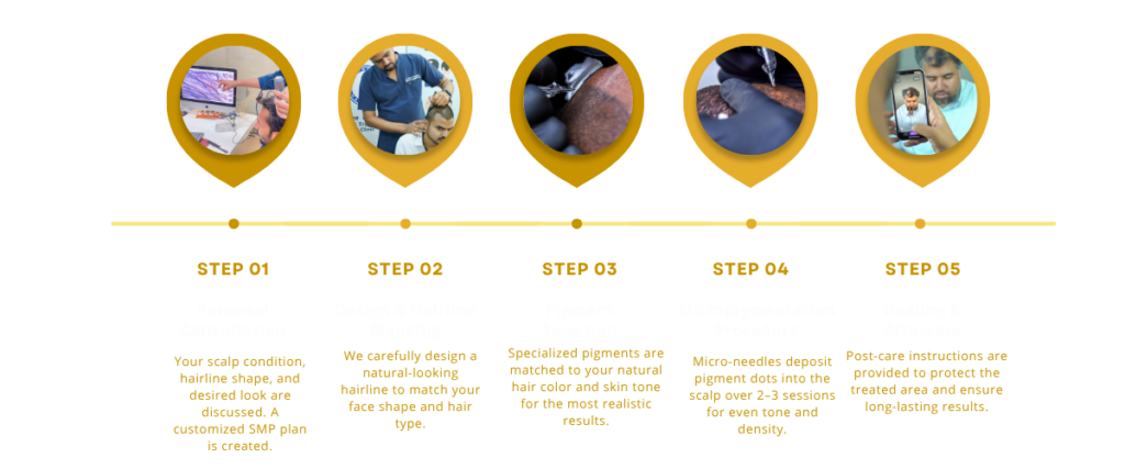Steps in scalp micropigmentation