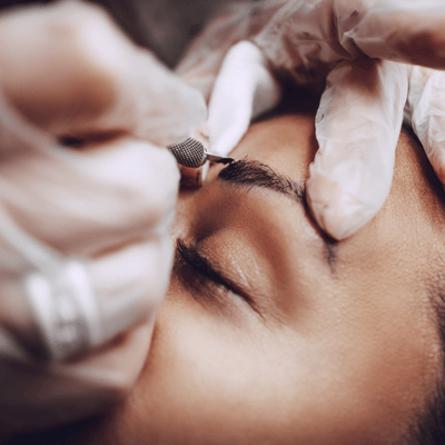 Eyebrow Hair Transplant