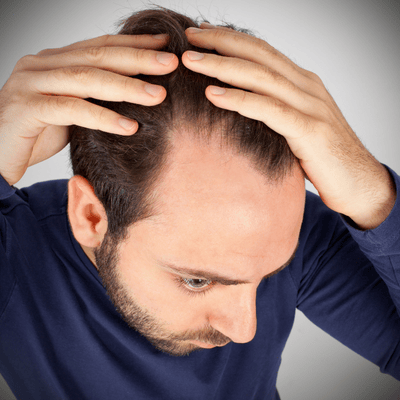 what is Hairline Reconstruction