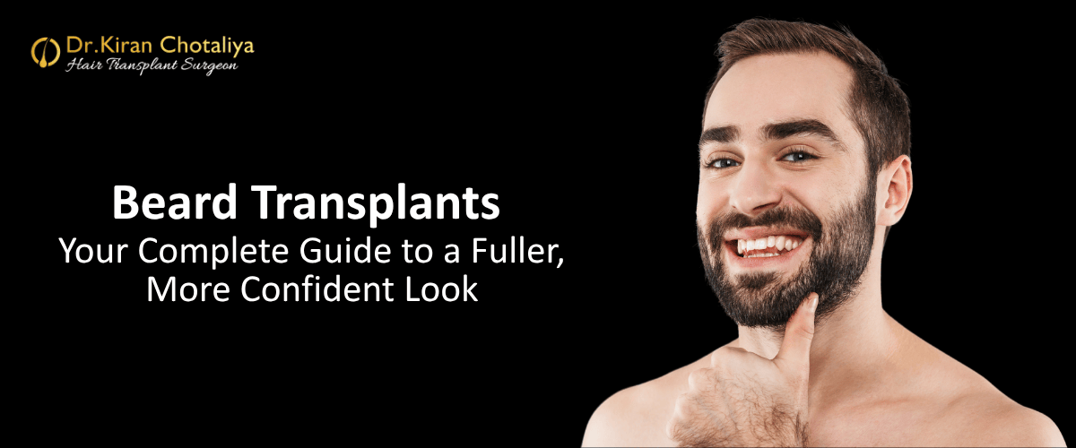 Beard Transplants Explained: Your Complete Guide to a Fuller Beard