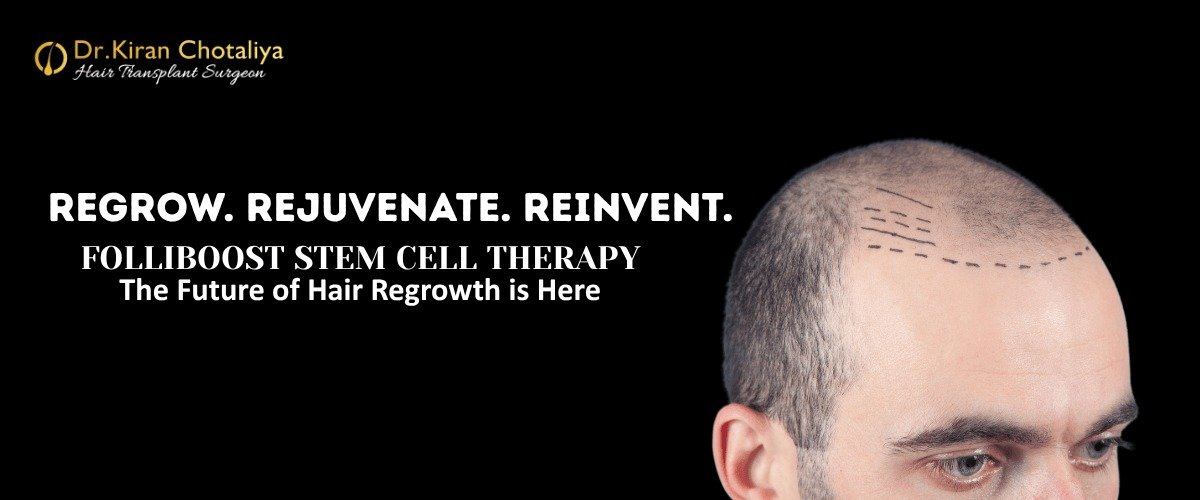 Folliboost stem cell treatment for hair growth in hair disorders