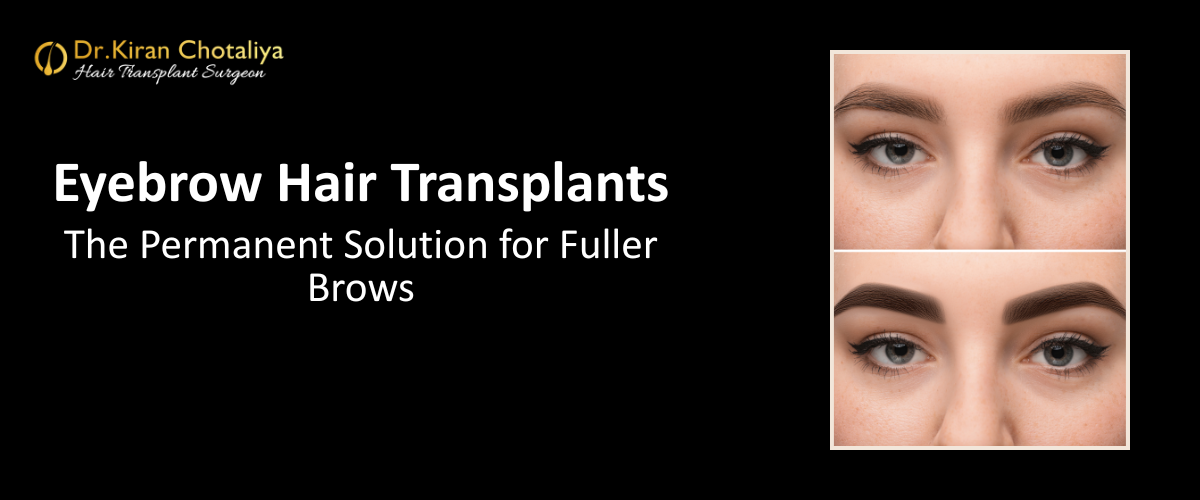 The Permanent Solution for Fuller Brows: Understanding Eyebrow Hair Transplants