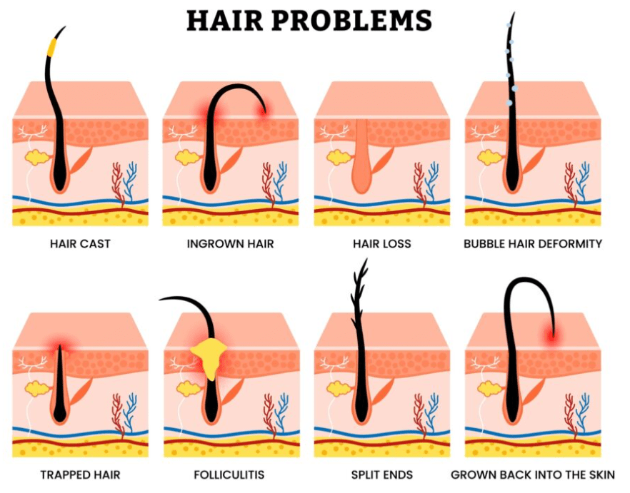 common hair problems