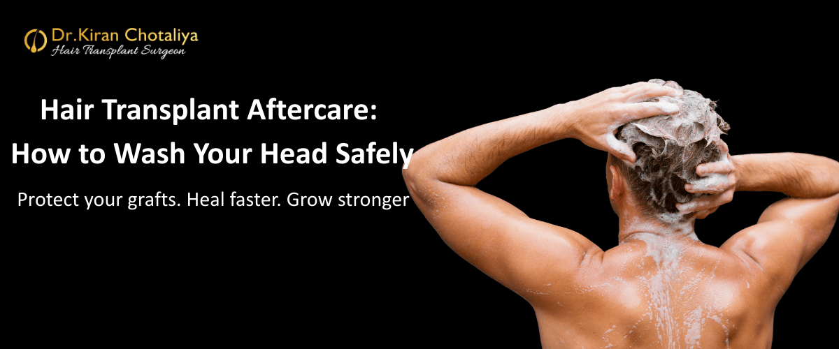 Head Wash After Hair Transplant: Complete Step-by-Step Care Guide
