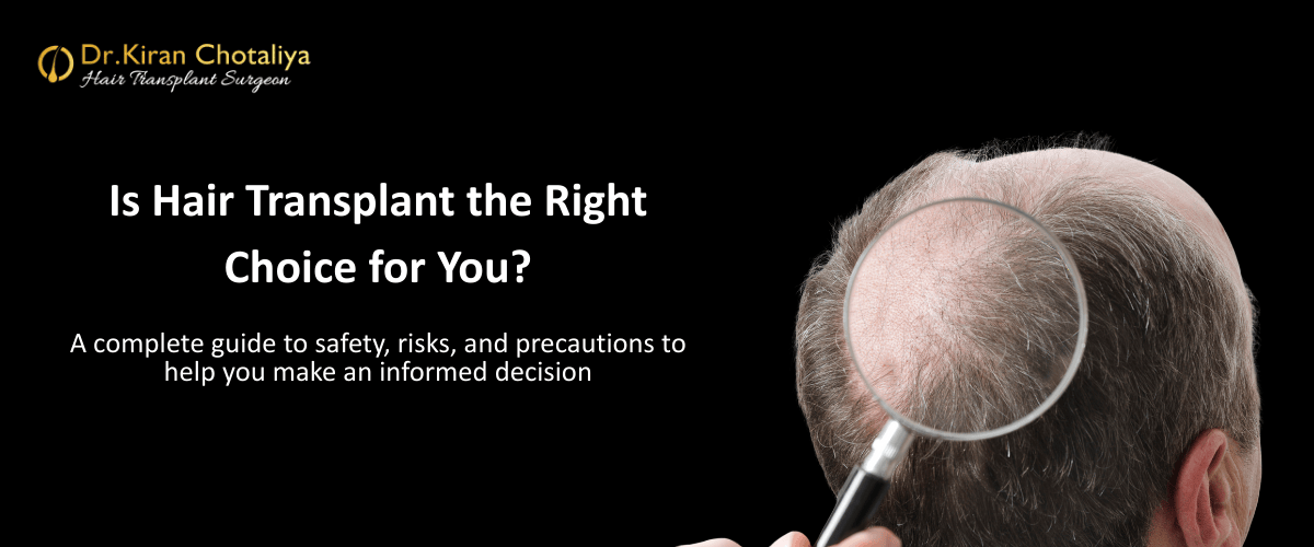 Is Hair Transplant Safe? A Comprehensive Guide to Understanding the Procedure and Minimizing Risks