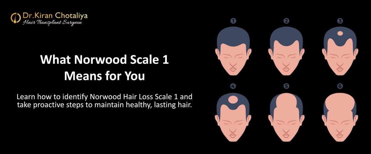 Understanding the Norwood Hair Loss Scale: What Does Norwood Scale 1 Mean for You?