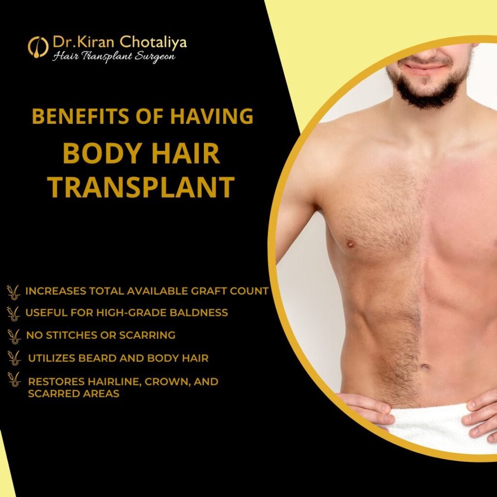 Bady hair Transplant