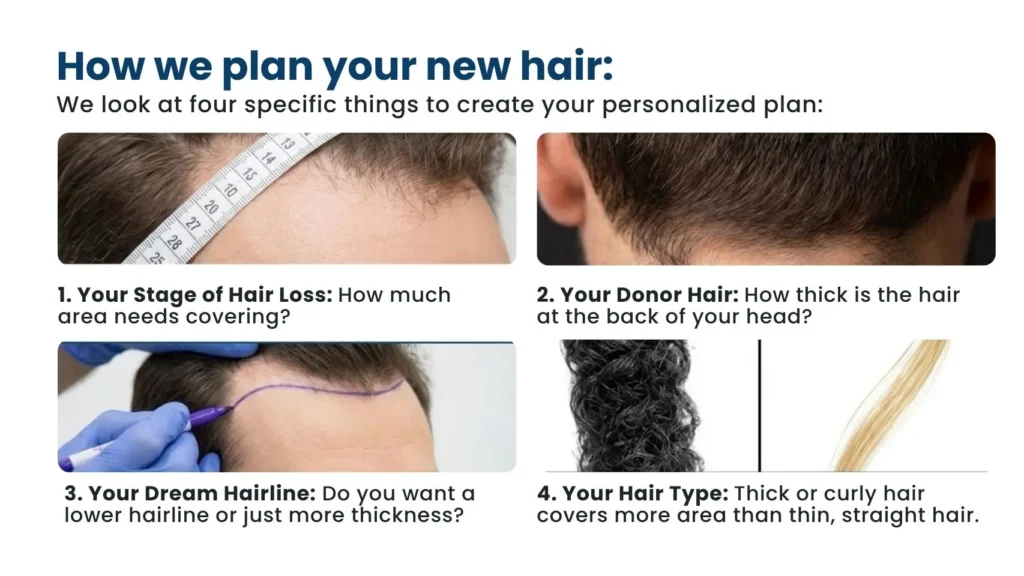 How Many Grafts Are Needed for Hair Transplant, Hair transplant growth after surgery, Hair Transplant In Pune, dr. kiran chotaliya clinic