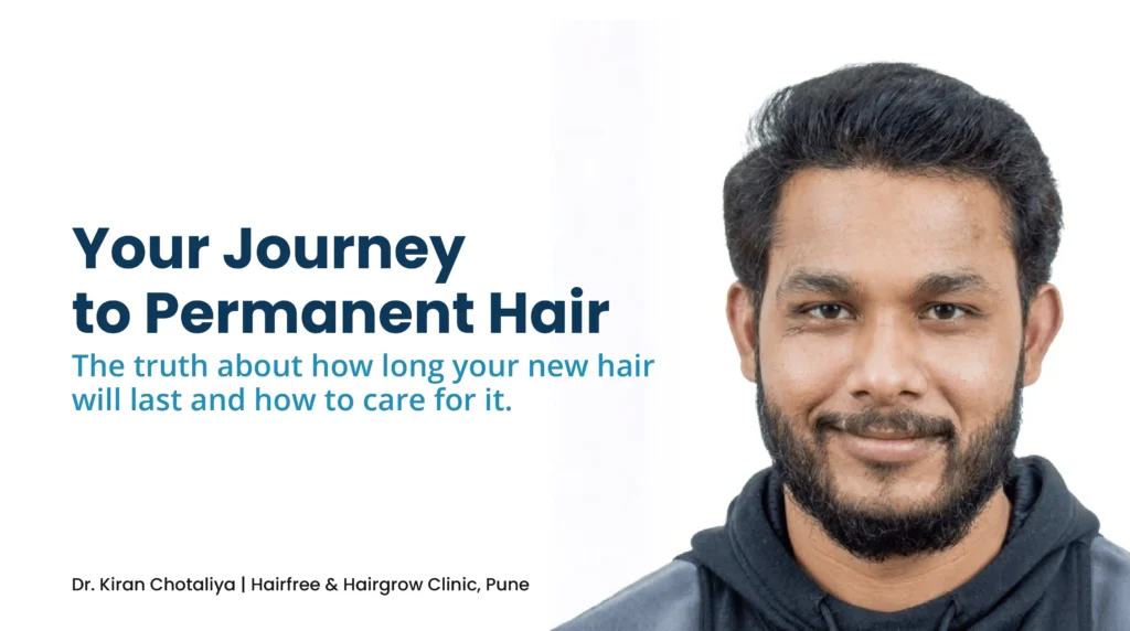 Is Hair Transplant Permanent