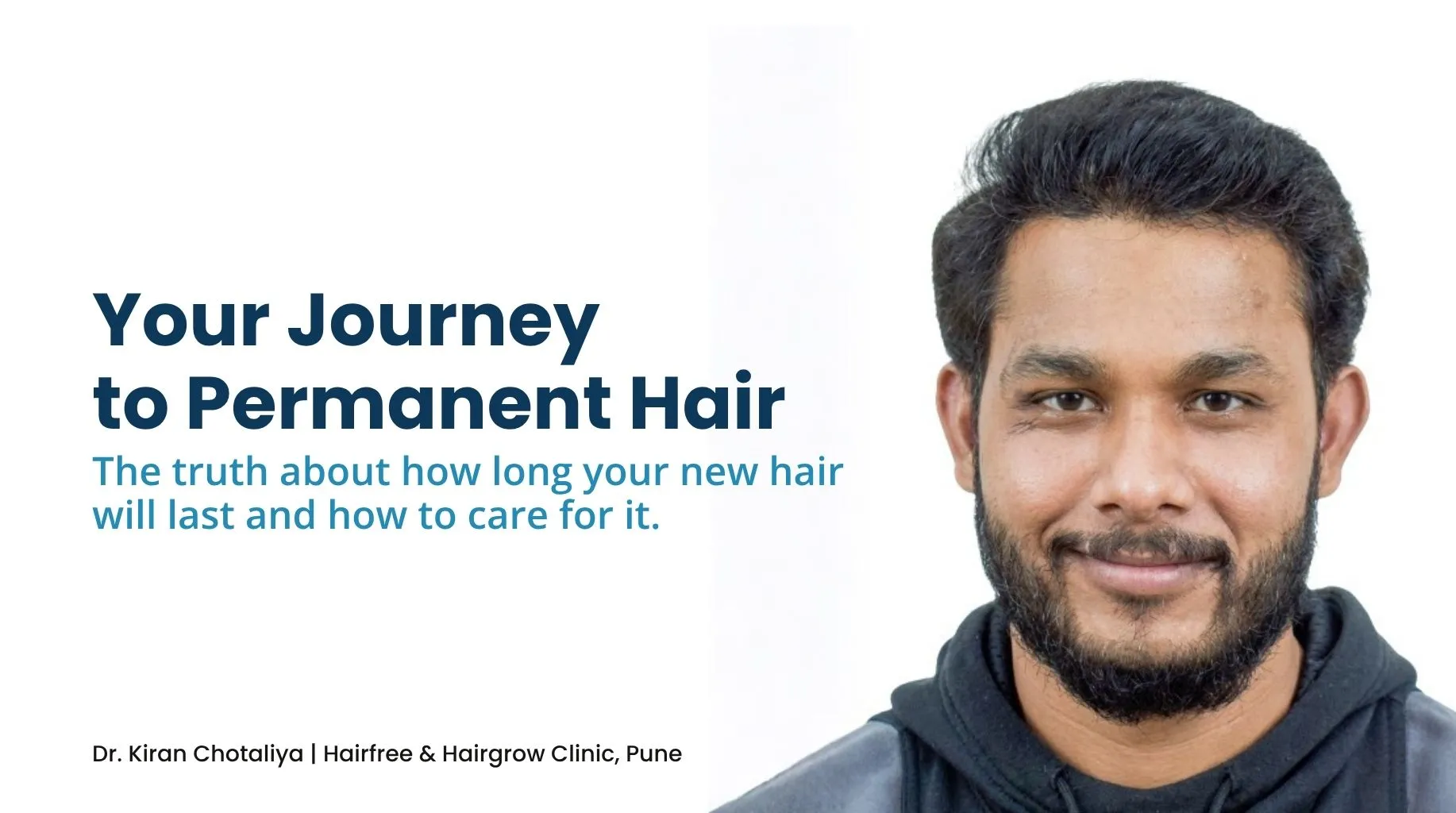 Is Hair Transplant Permanent, Hair transplant growth after surgery, Hair Transplant In Pune, dr. kiran chotaliya clinic