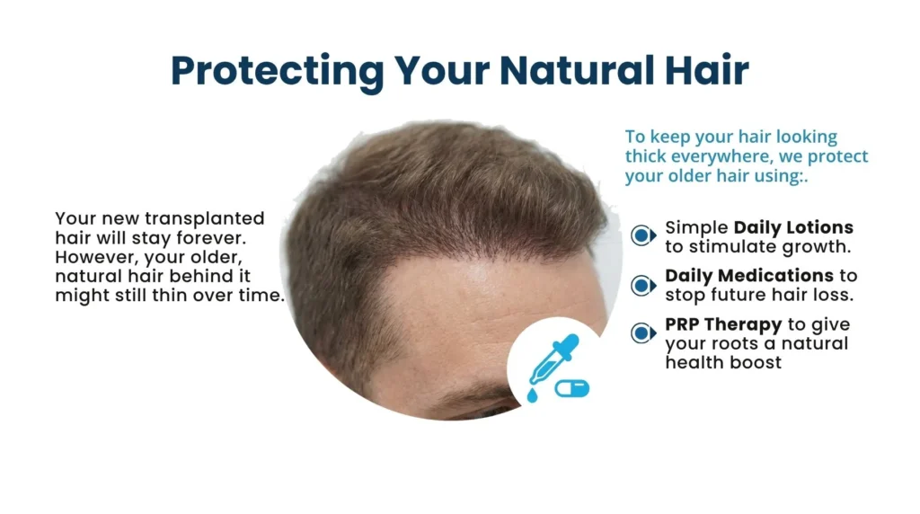 Treatments to maintain hair transplant results in Pune clinic Hair TrIansplant In Pune, dr. kiran chotaliya clinic