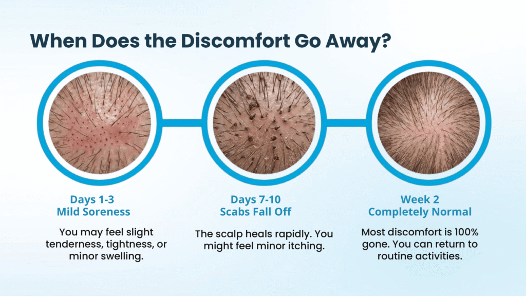 When Does Discomfort Completely Go Away
