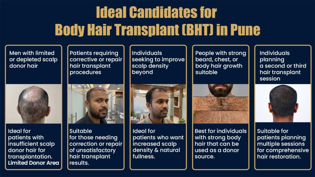 Ideal Candidates for Body Hair Transplant in Pune Including Patients with Limited Donor Hair and Advanced Hair Loss