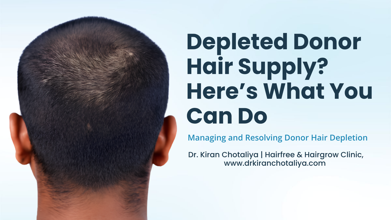 Depleted donor hair supply