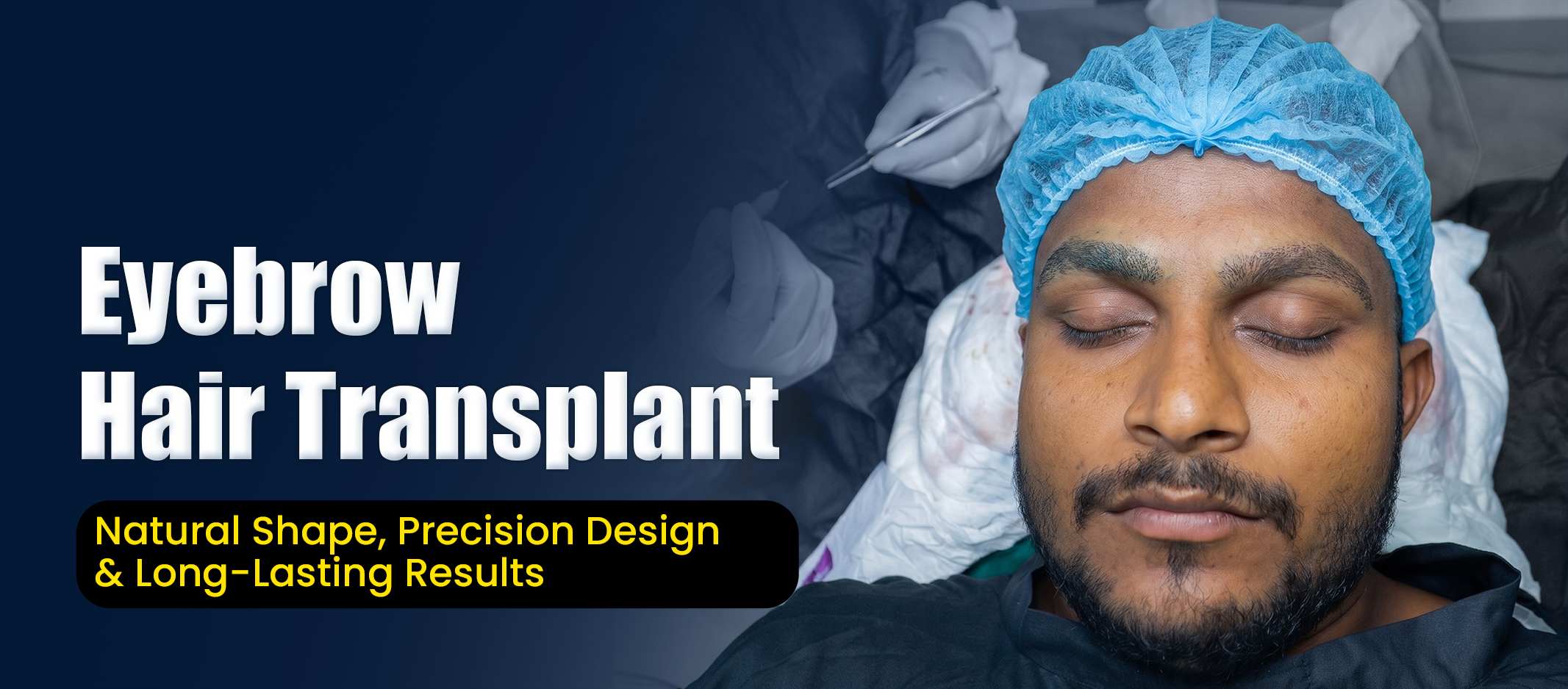 Eyebrow Hair Transplant in Pune – Patient Undergoing Precision Eyebrow Restoration Procedure