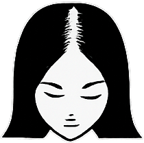 Graphic of Ludwig Grade I-III female pattern hair thinning treated with specialized hair transplant procedures in Pune.