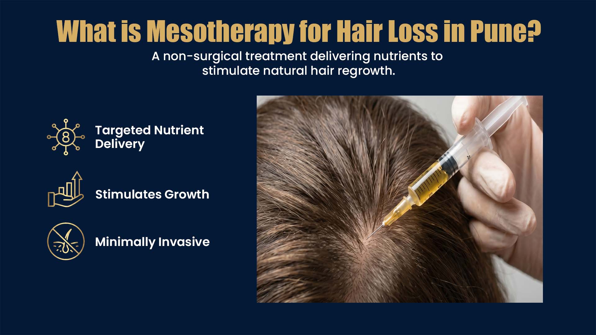 Mesotherapy for Hair Loss in Pune Showing Nutrient Injection Therapy for Hair Regrowth and Scalp Nourishment