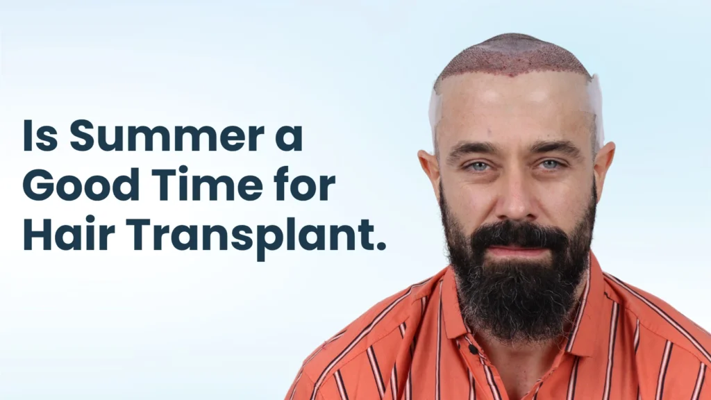 Best time for hair transplant in Pune showing a patient after hair transplant during summer recovery