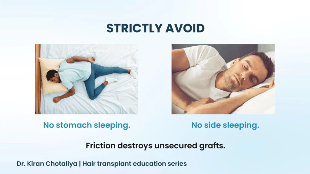 Common sleeping mistakes after hair transplant in Pune that can affect recovery