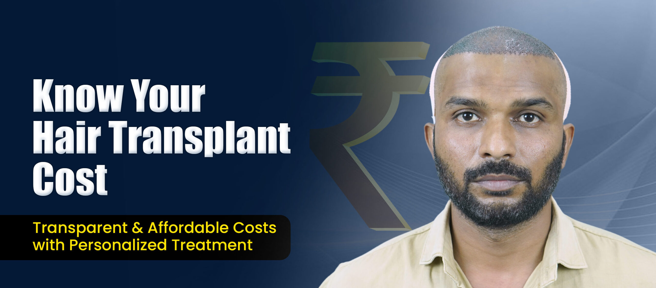 Hair Transplant Cost in Pune by Dr. Kiran Chotaliya at Hairfree & Hairgrow Clinic