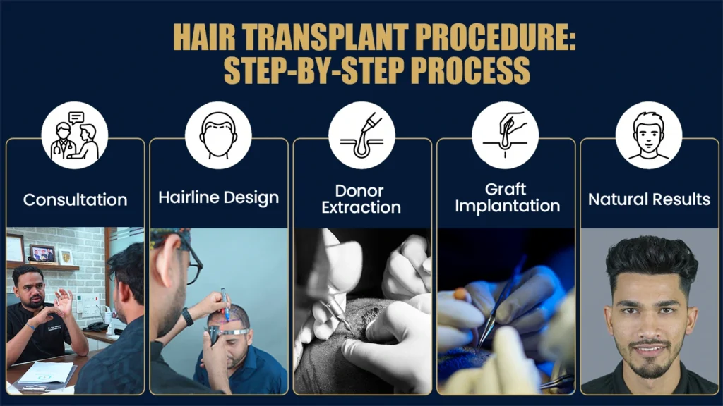 Step-by-step hair transplant procedure in Pune showing consultation, hairline design, donor extraction, graft implantation, and final results