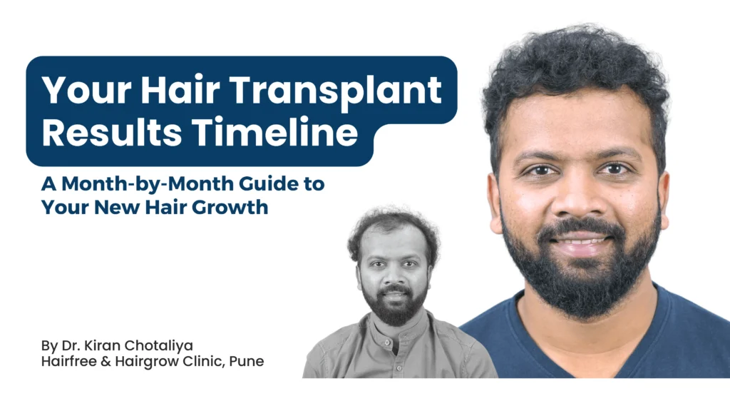 Alt Tag: Hair Transplant Results Timeline in Pune showing month-by-month hair growth after surgery