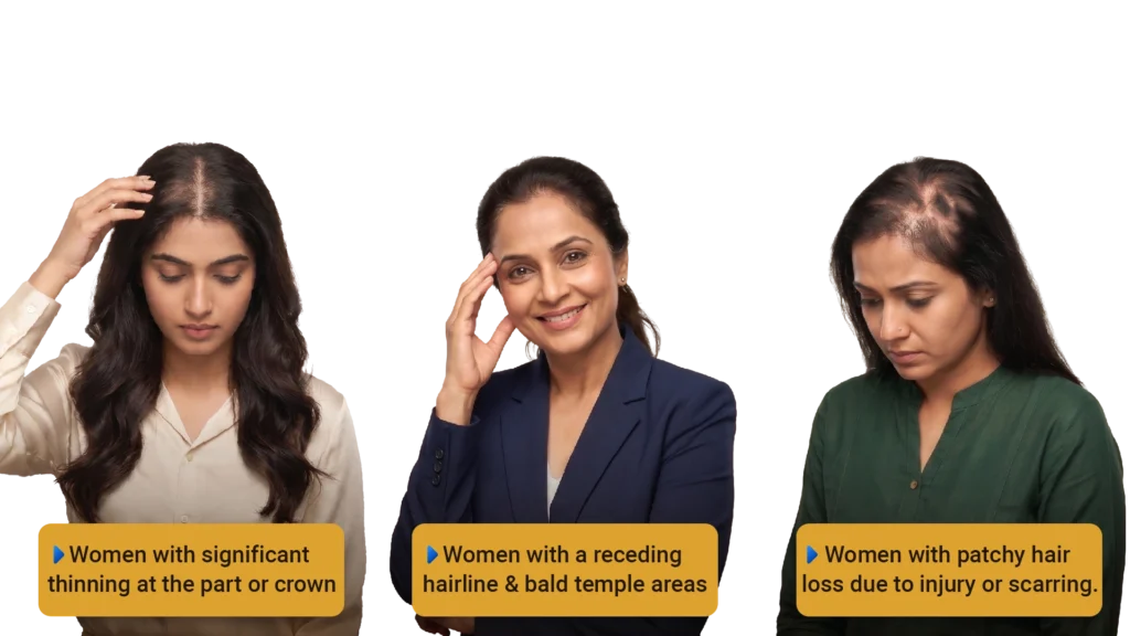 Guide on female hair transplant candidacy, crown hair thinning patterns, and hair loss treatments in Pune.