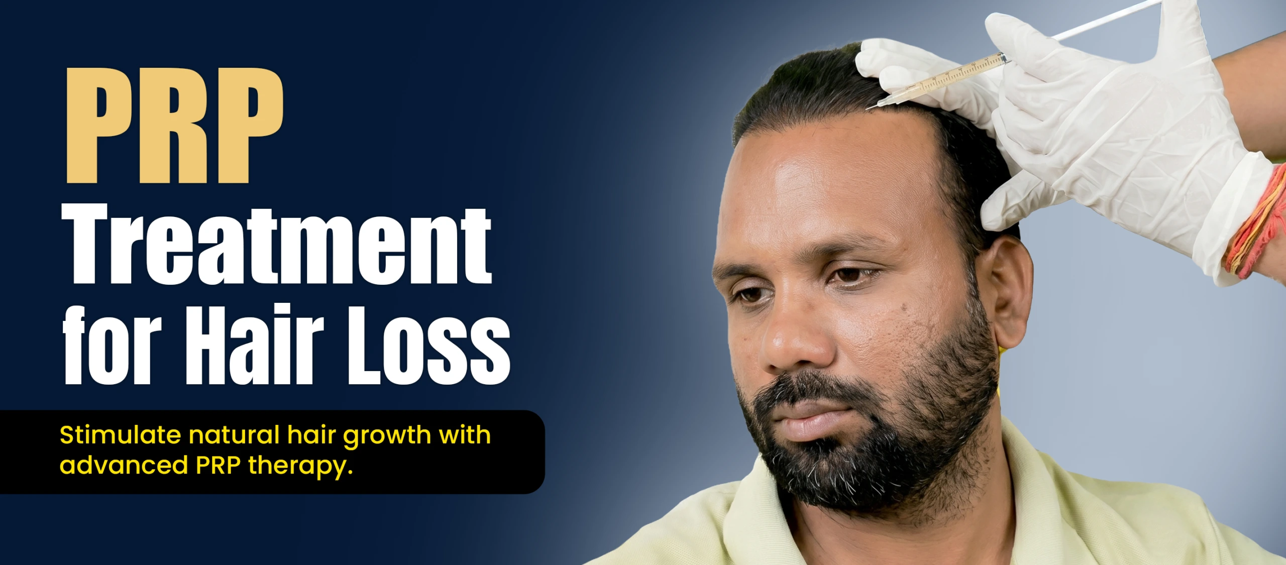 PRP Treatment for Hair Loss in Pune Showing Platelet-Rich Plasma Injection for Natural Hair Growth Stimulation