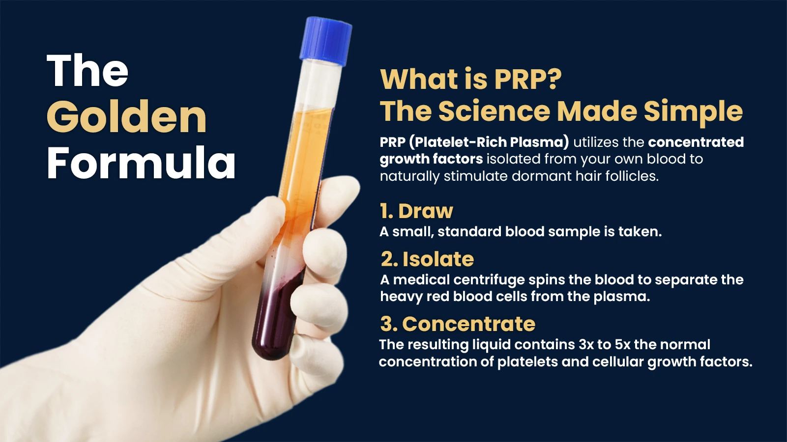 PRP Treatment for Hair Loss in Pune Showing Platelet-Rich Plasma Preparation Process for Natural Hair Growth