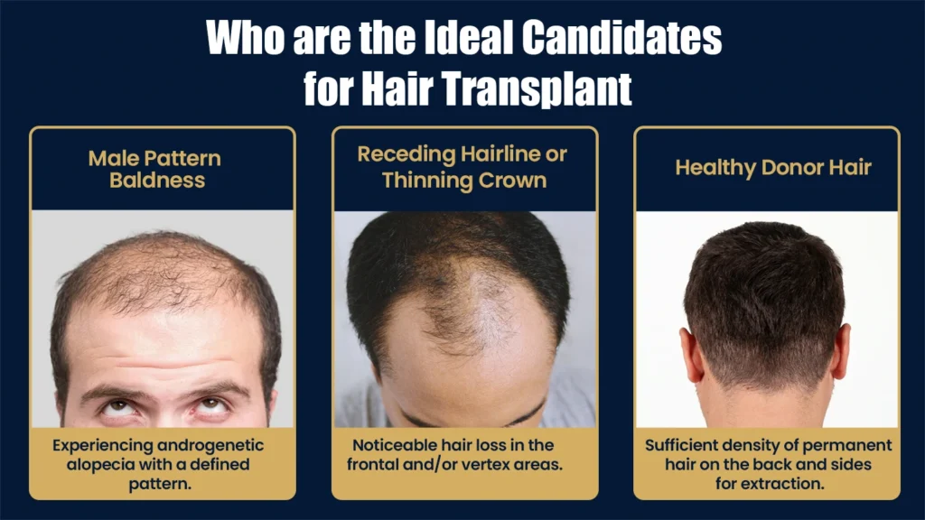 Ideal candidates for hair transplant in Pune including men with male pattern baldness, receding hairline, and healthy donor hair