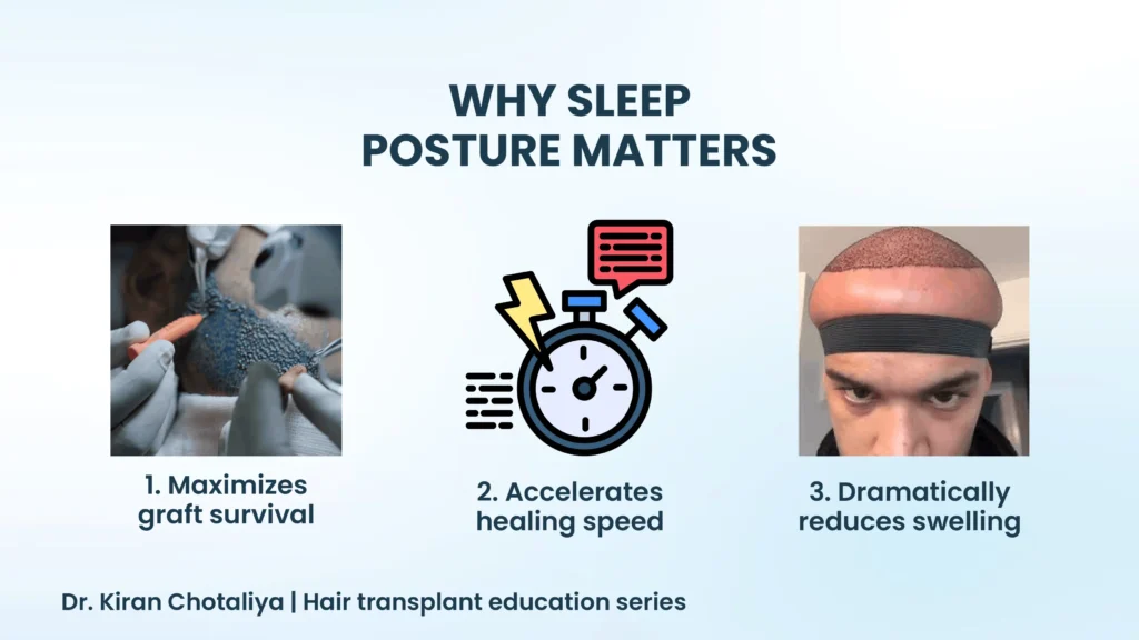 Why sleeping position matters after hair transplant in Pune for graft survival and faster healing