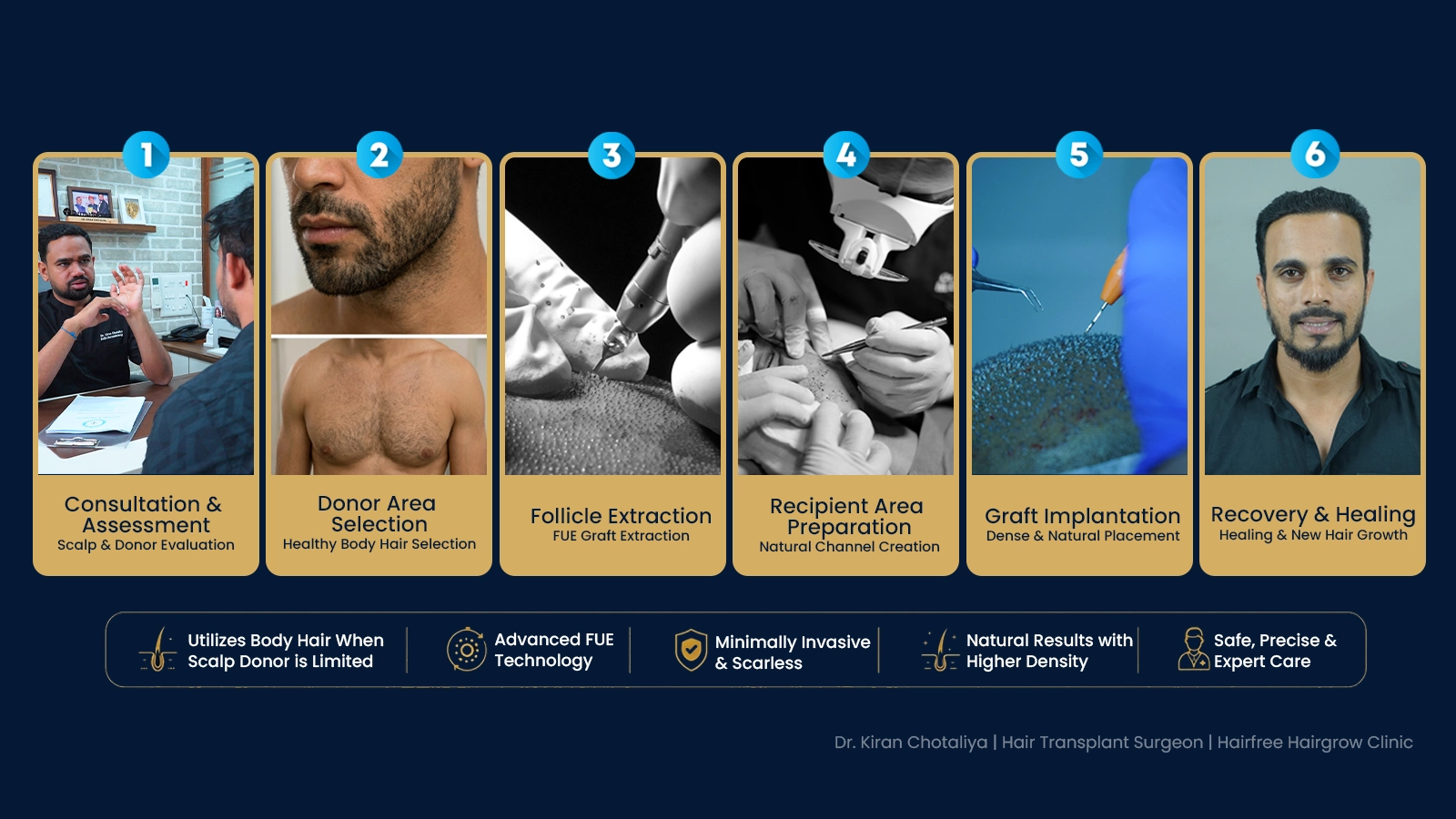 Body Hair Transplant Process in Pune Showing Consultation, Follicle Extraction, Graft Implantation and Recovery Stages