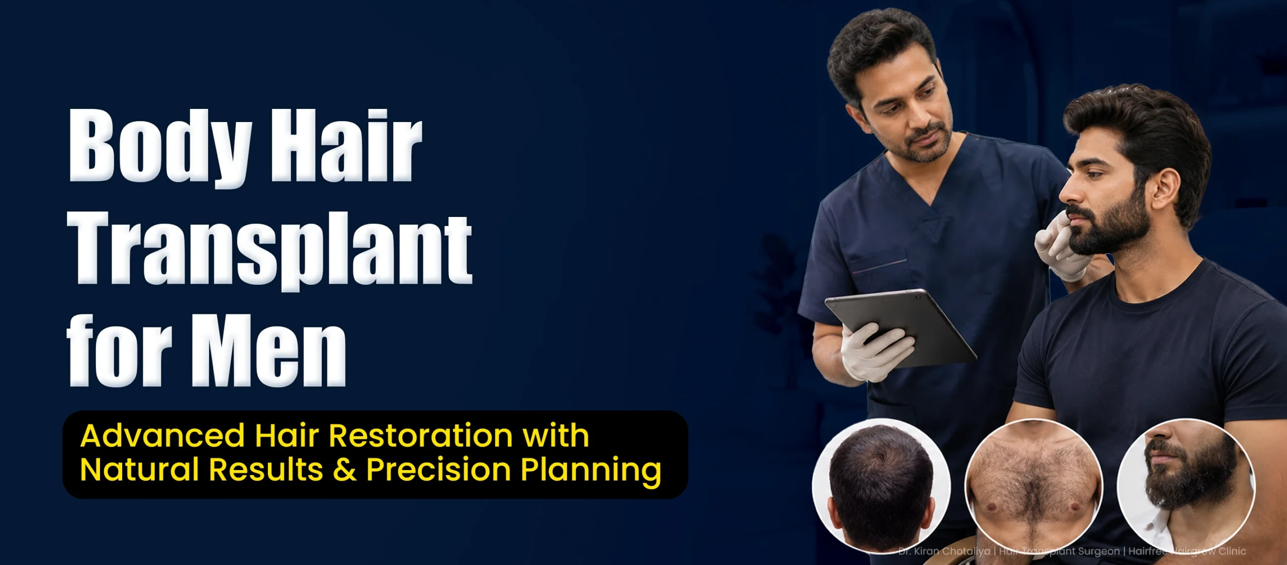 Body Hair Transplant in Pune for Men with Natural Hair Restoration and Precision Planning