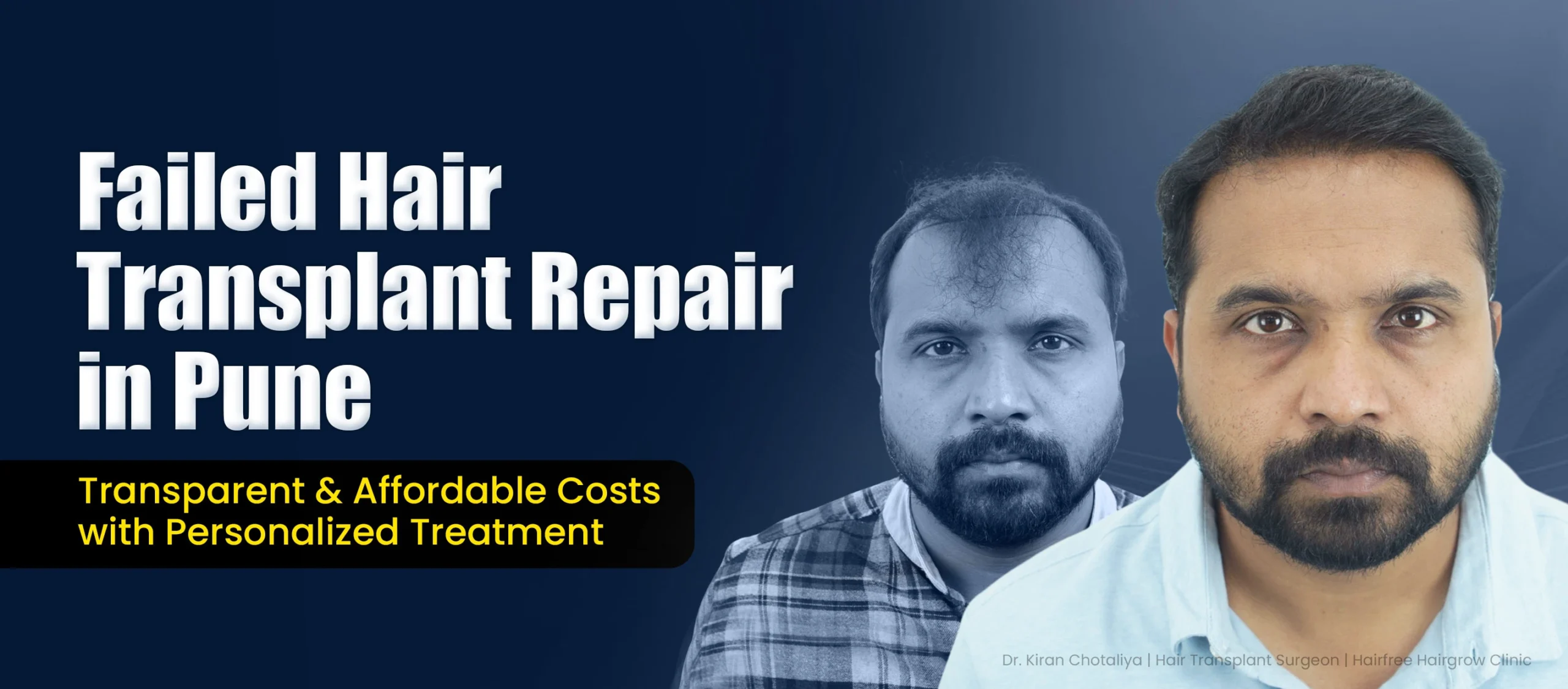 Failed Hair Transplant Treatment in Pune showing poor hair growth and corrective hair restoration treatment results