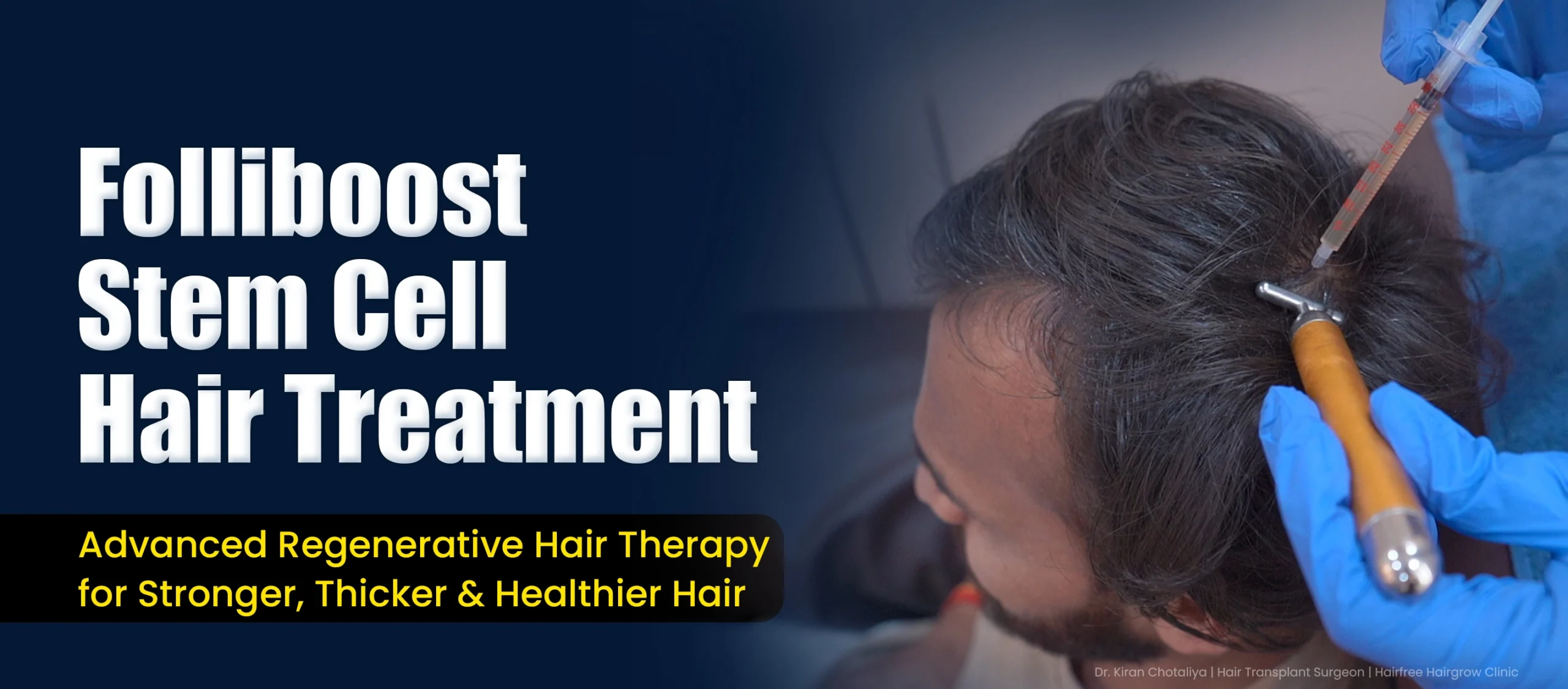 Patient receiving Folliboost Stem Cell Hair Treatment in Pune by Dr. Kiran Chotaliya for advanced hair restoration and natural hair growth.