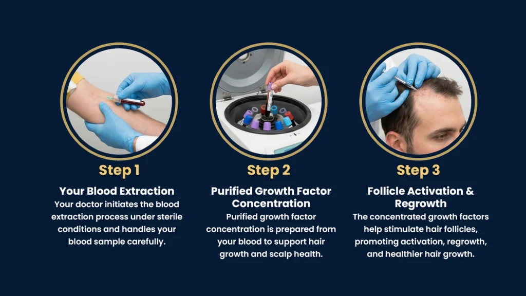 Step-by-step GFC Treatment in Pune showing blood extraction, growth factor concentration, and hair follicle stimulation