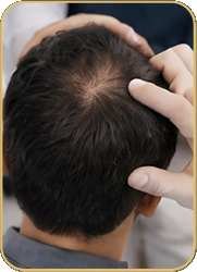 Hair-Loss-Assessment-