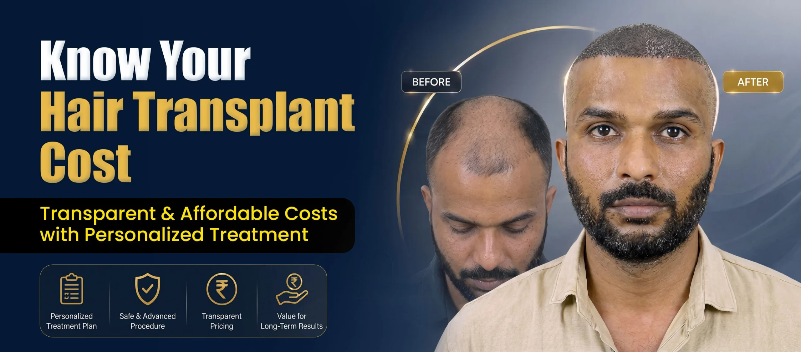 Hair Transplant Cost in Pune by Dr. Kiran Chotaliya at Hairfree & Hairgrow Clinic