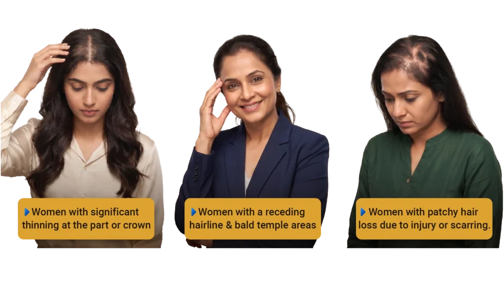 Guide on female hair transplant candidacy, crown hair thinning patterns, and hair loss treatments in Pune.